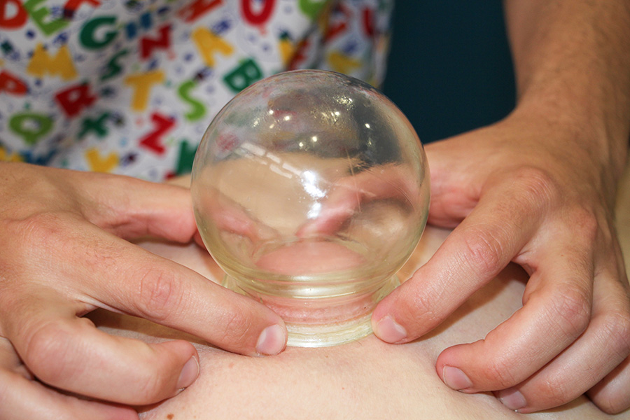 moxibustion-3